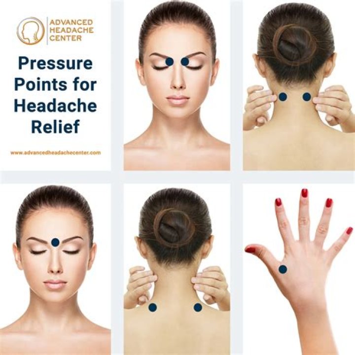 Can acupuncture treat tension headaches?