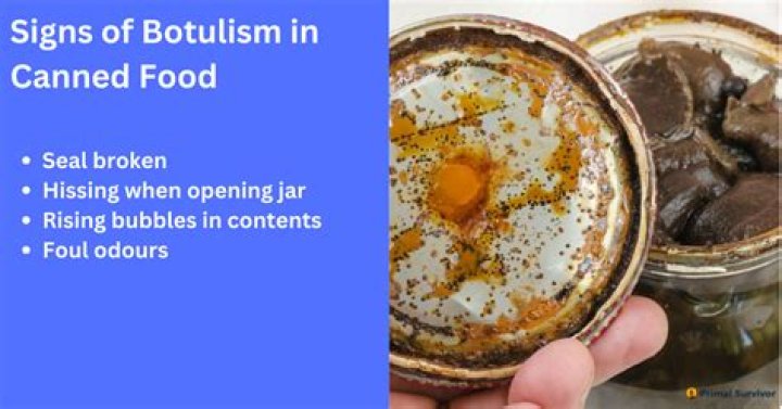 Can Chili cause botulism?