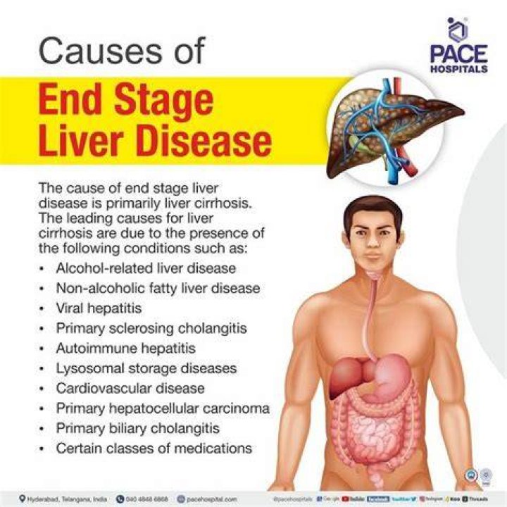 Can liver problems cause vomiting?