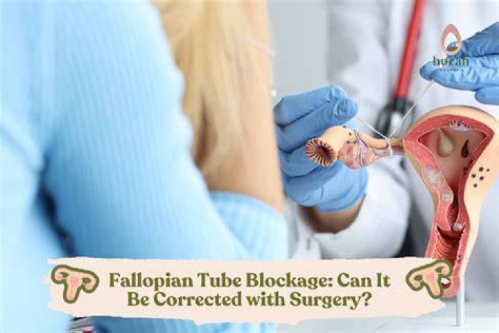 Can Yoni steam unblock fallopian tubes?