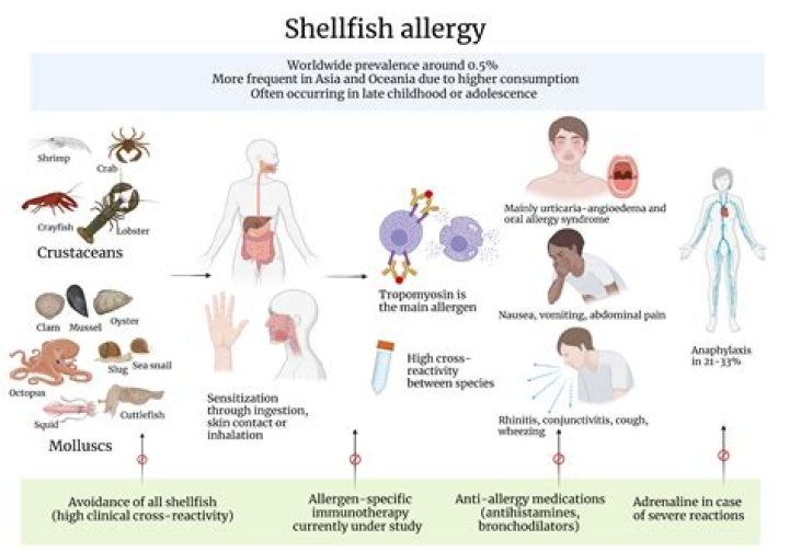 Can you be allergic to only fish?