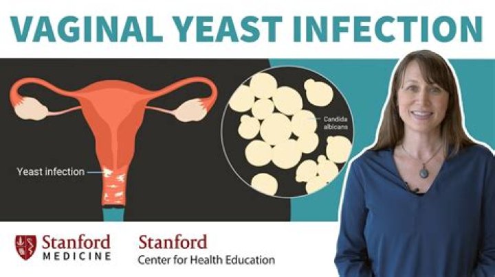 Can you get a yeast infection on your cervix?