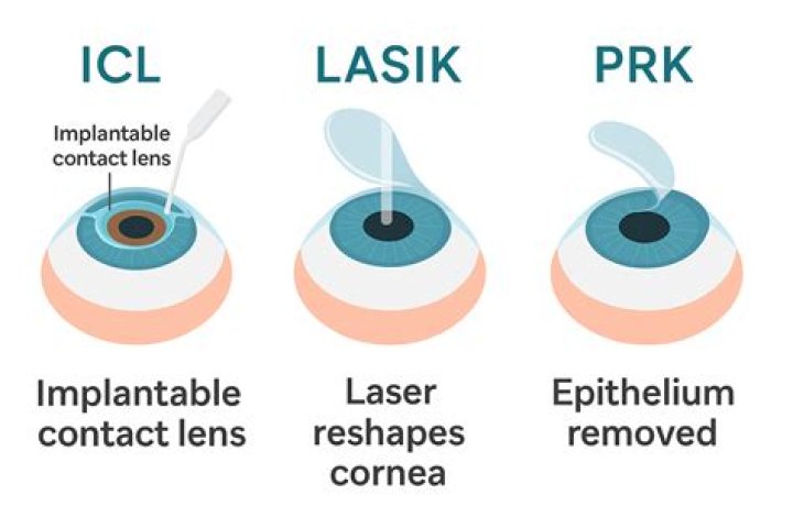 Can you wear glasses with ICL?