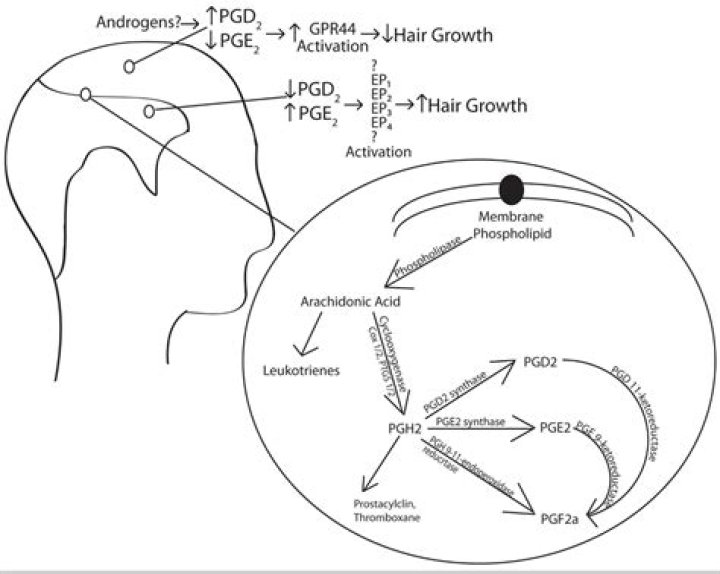 Does PGD2 cause hair loss?