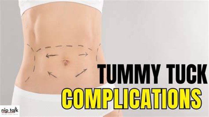 How can you tell if you messed up your tummy tuck?