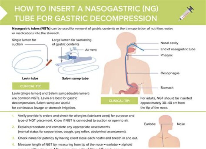 How do you confirm placement of nasogastric tube?