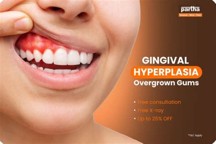 How do you describe gingival hyperplasia?