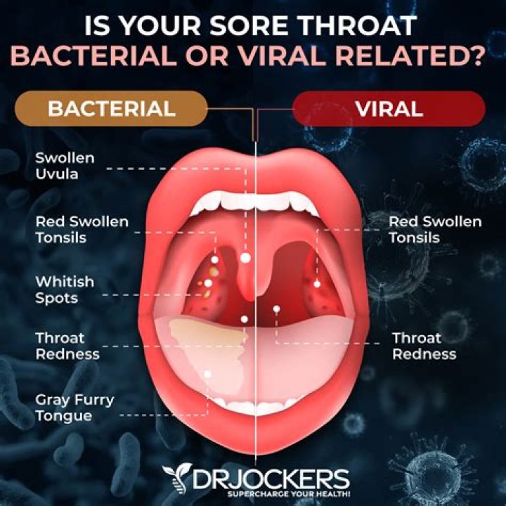 How do you treat a viral throat ulcer?