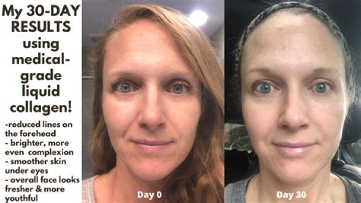 How long does Biogen collagen take to work?