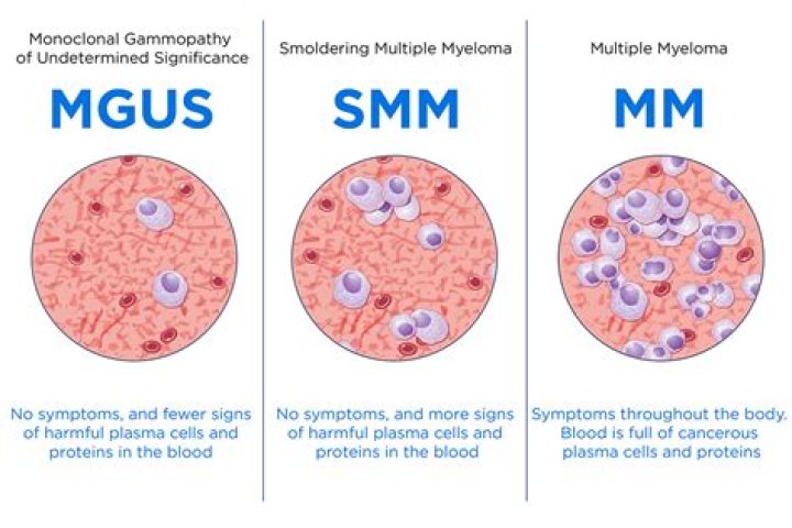 How long is the average remission for multiple myeloma?