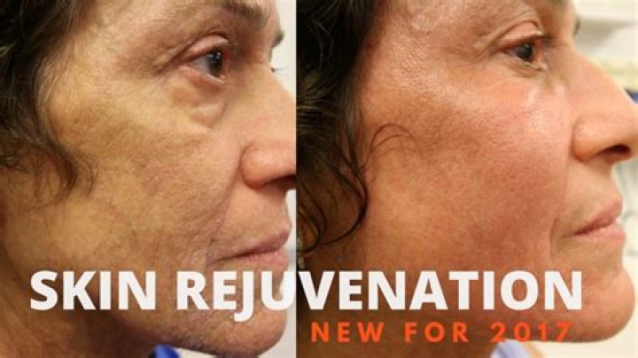 Is rejuvenating good for skin?