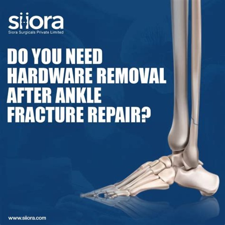 Should I have my ankle hardware removed?