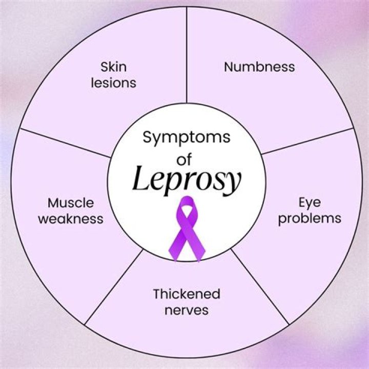 What are the 3 main symptoms of leprosy?