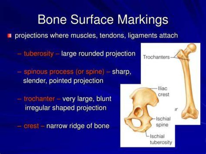 What are the three types of bone markings?