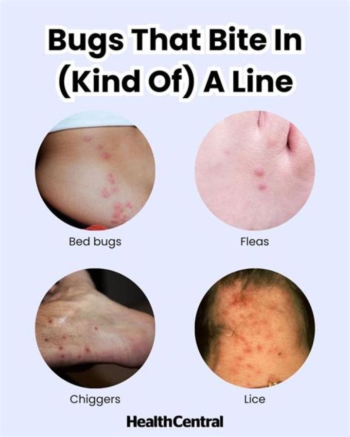 What bug bites in a line?