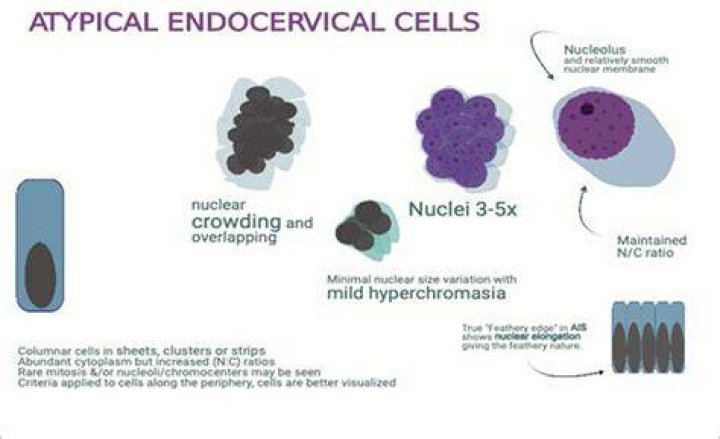 What causes atypical cells in cervix?