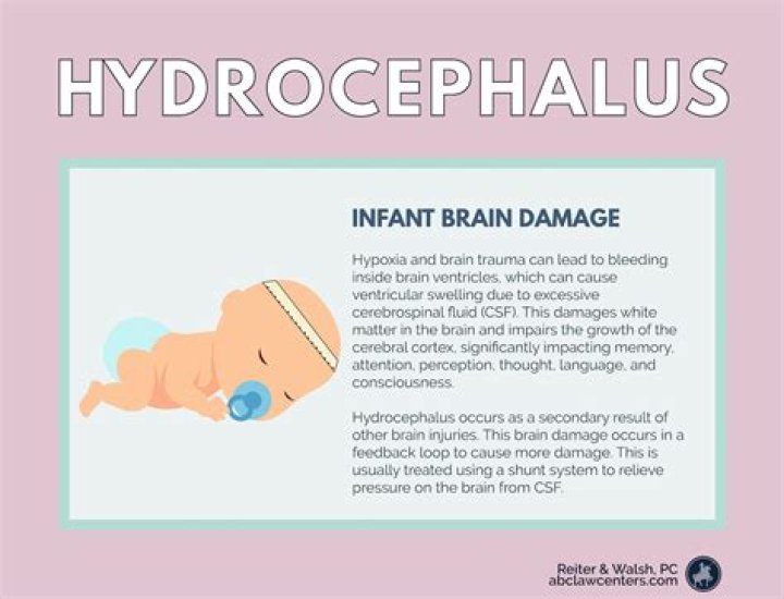 What causes hydrocephalus myelomeningocele?