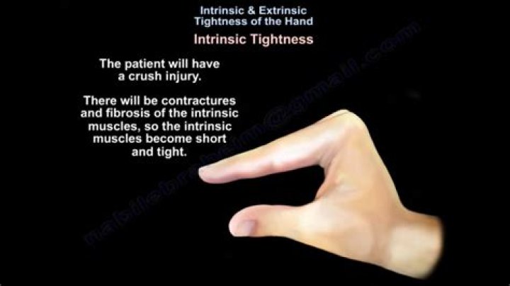 What causes intrinsic tightness?