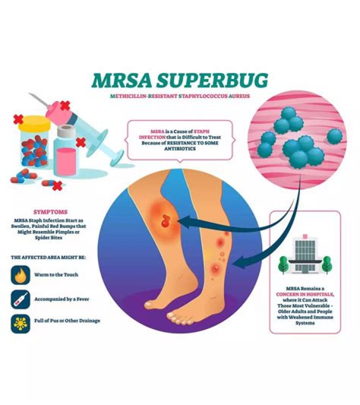 What causes repeated MRSA infections?