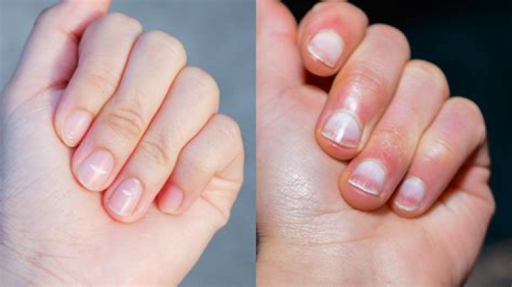 What do you do if your nail breaks down halfway?