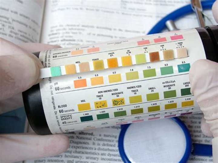 What does a 9 panel urinalysis test for?