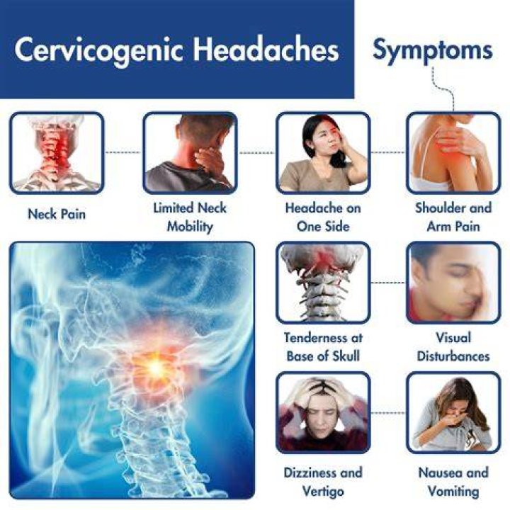 What does a cervicogenic headache feel like?