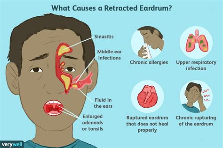 What does ear infection fluid look like?