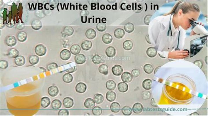 What does moderate white blood cells in urine mean?