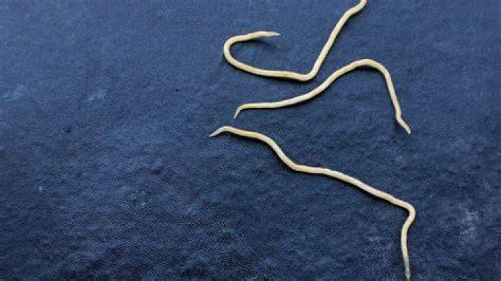 What does ribbon worm look like?