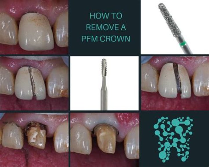 What does the PFM Group do?