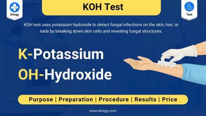 What happens if you get potassium hydroxide on your skin?