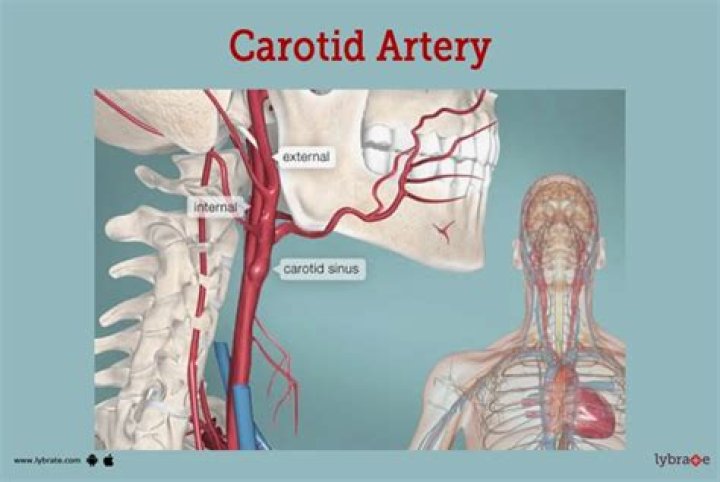 What happens if you press too hard on the carotid artery?