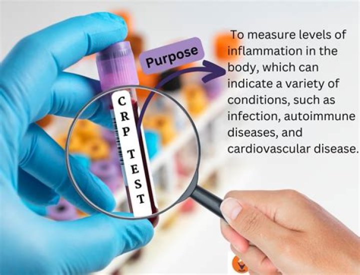 What is included in PSUR?