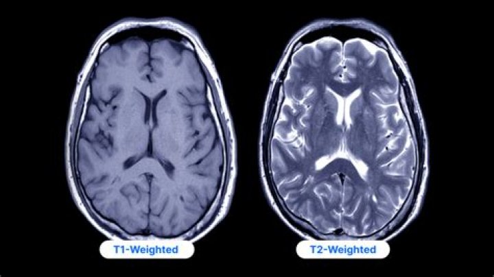 What is T2 in MRI?