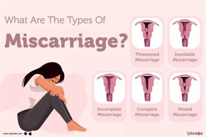 What is the best option for miscarriage?