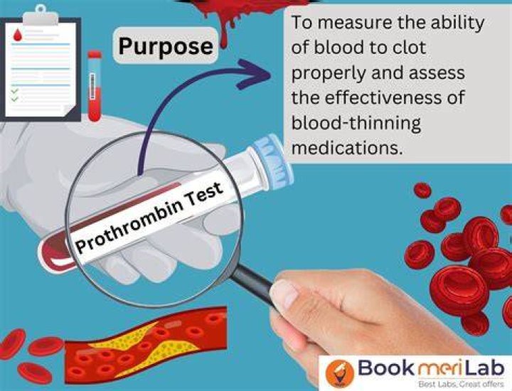 What is the prothrombin gene?
