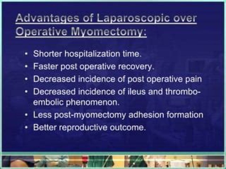What is the recovery time for laparoscopic myomectomy?