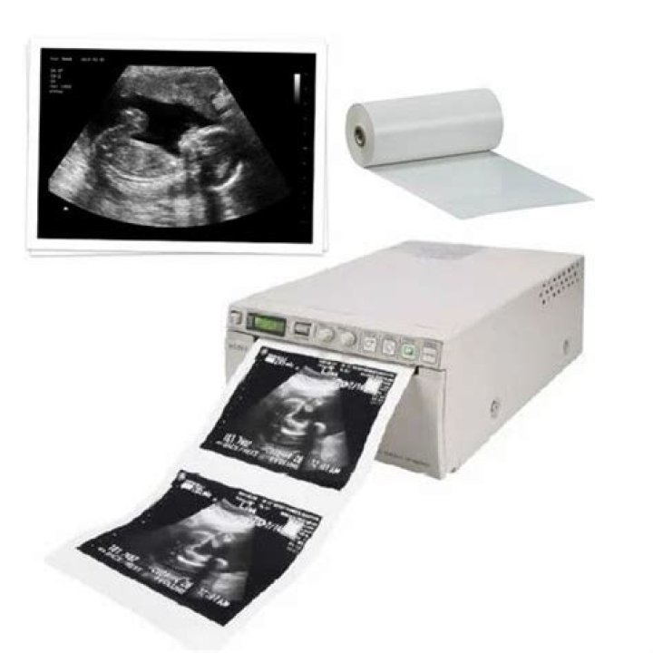 What paper is used to print ultrasounds?