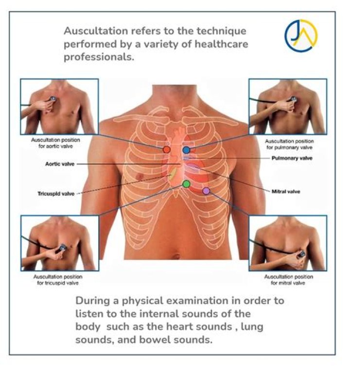 Where do you Auscultate NGT placement?