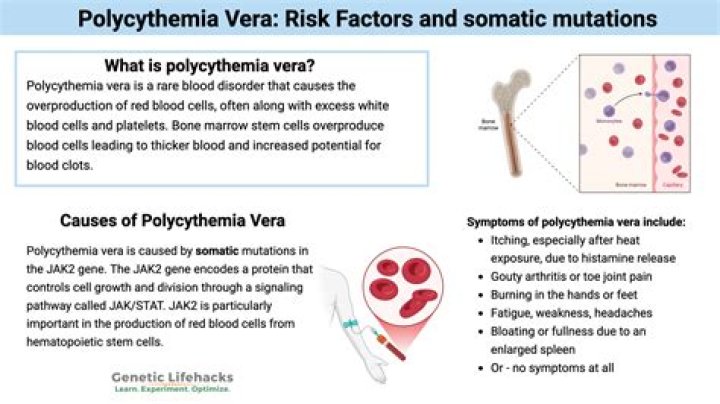 Which is a major complication of polycythemia?