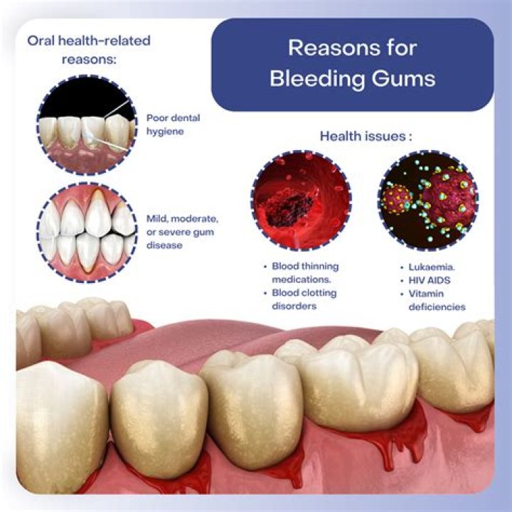 Why are my gums sensitive to sugar?