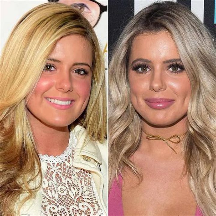 Why did Brielle have her jaw surgery?