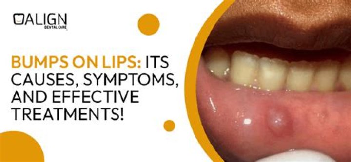 Why do I have a painless lump in my mouth?