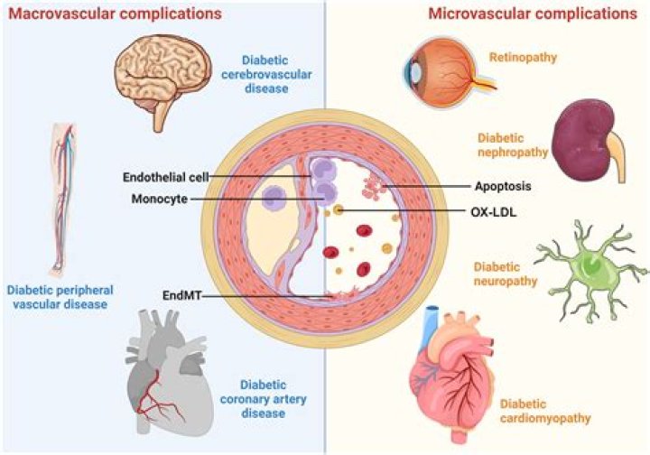 Why does diabetes cause macrovascular disease?