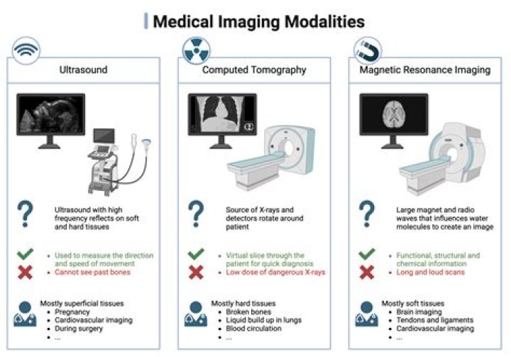 Why is maldi used for imaging?