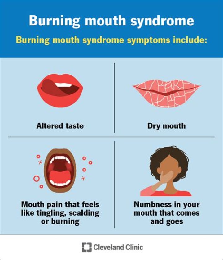 Will burning mouth syndrome go away?